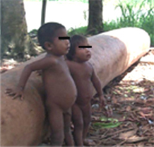 Niños del Delta de Orinoco afectados por parasitosis helmínticas